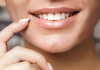 Entenda quais fatores podem te ajudar no Clareamento Dental