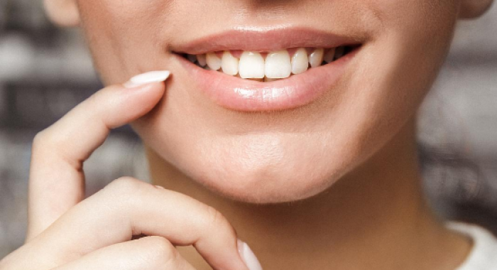 Entenda quais fatores podem te ajudar no Clareamento Dental